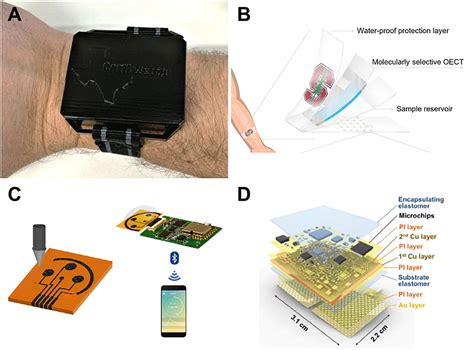 wearable stress monitoring technology